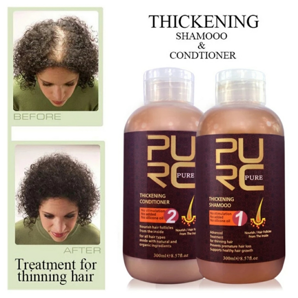 Hair loss treatment